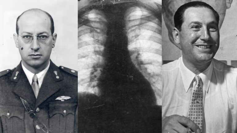 15 de octubre de 1945 Una radiografía fraguada